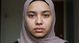 الحجامه و تنظيم الهرمونات للنساء 