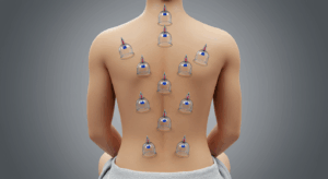 اكثر من 70 موضع للحجامه
