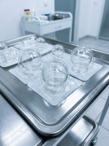 حجامة بكاسات معقمة
